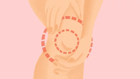 Ilustración de una mujer con dolor articular en la rodilla