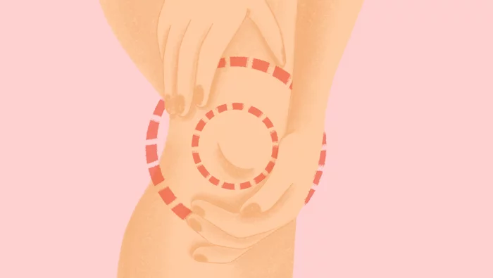 Ilustración de una mujer con dolor articular en la rodilla