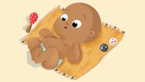 Ilustración de un bebé con hernia umbilical